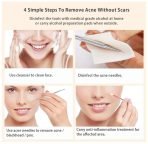 Face Steamer - Image 4